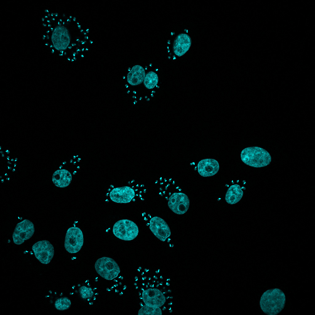 Infección revelada :: cienciaenimagenes-pasteur