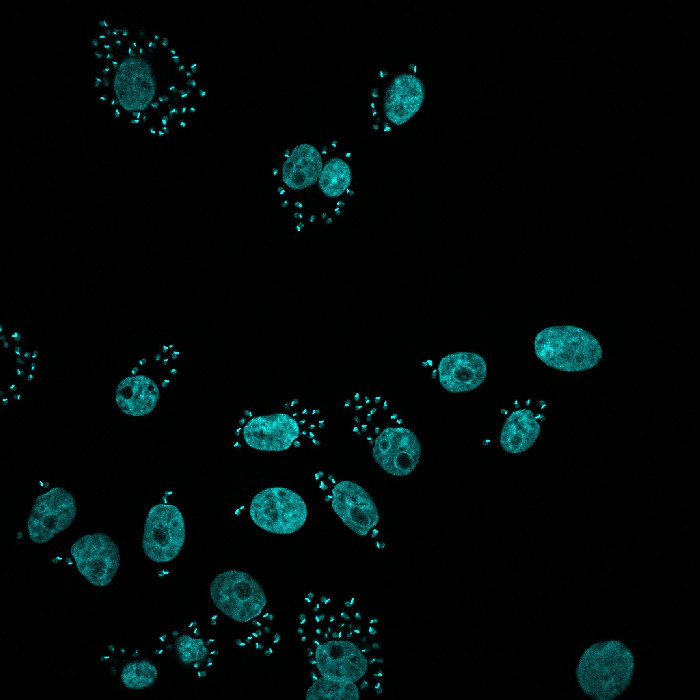 Infección revelada :: cienciaenimagenes-pasteur